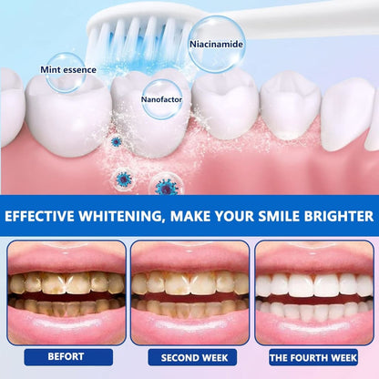Niacinamide Whitening Toothpaste ( Buy 1 Get 1 Free )